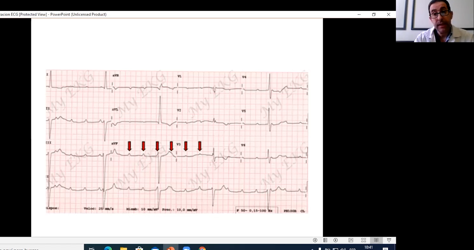 10 Monitorización ECG. Parte 2