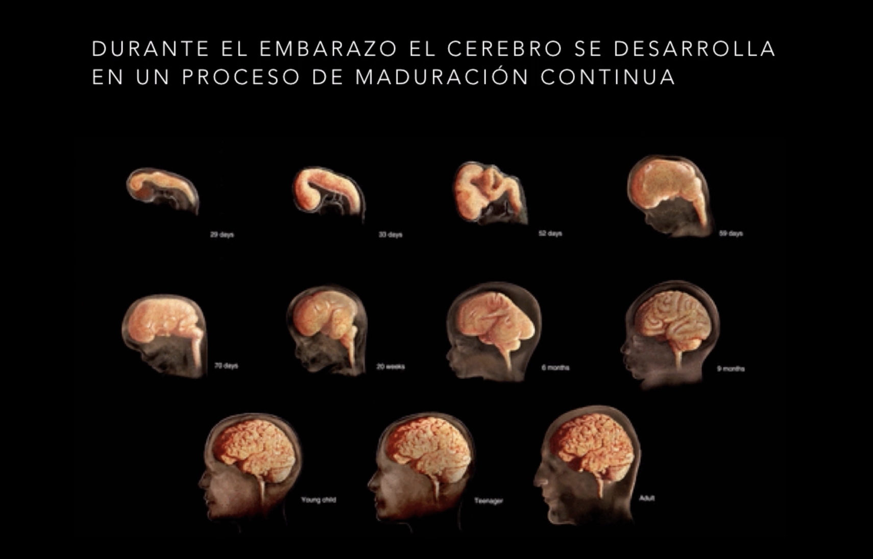 Video presentación de neuroprotección